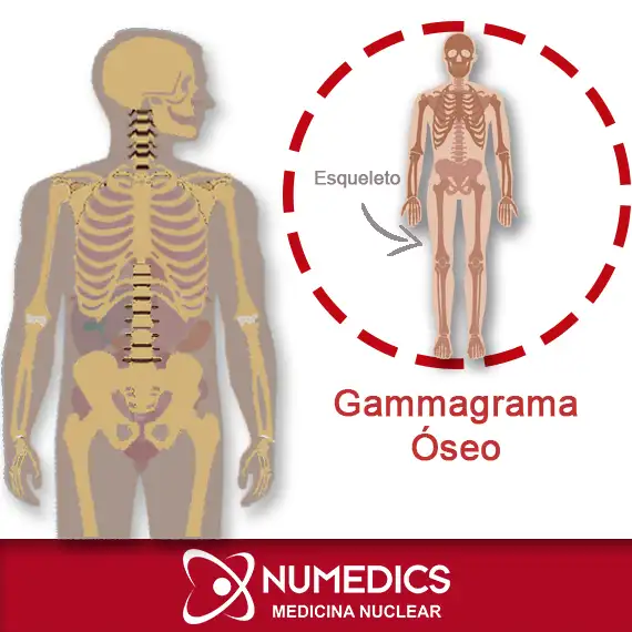Gammagrama Óseo