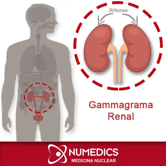 Gammagrama Renal